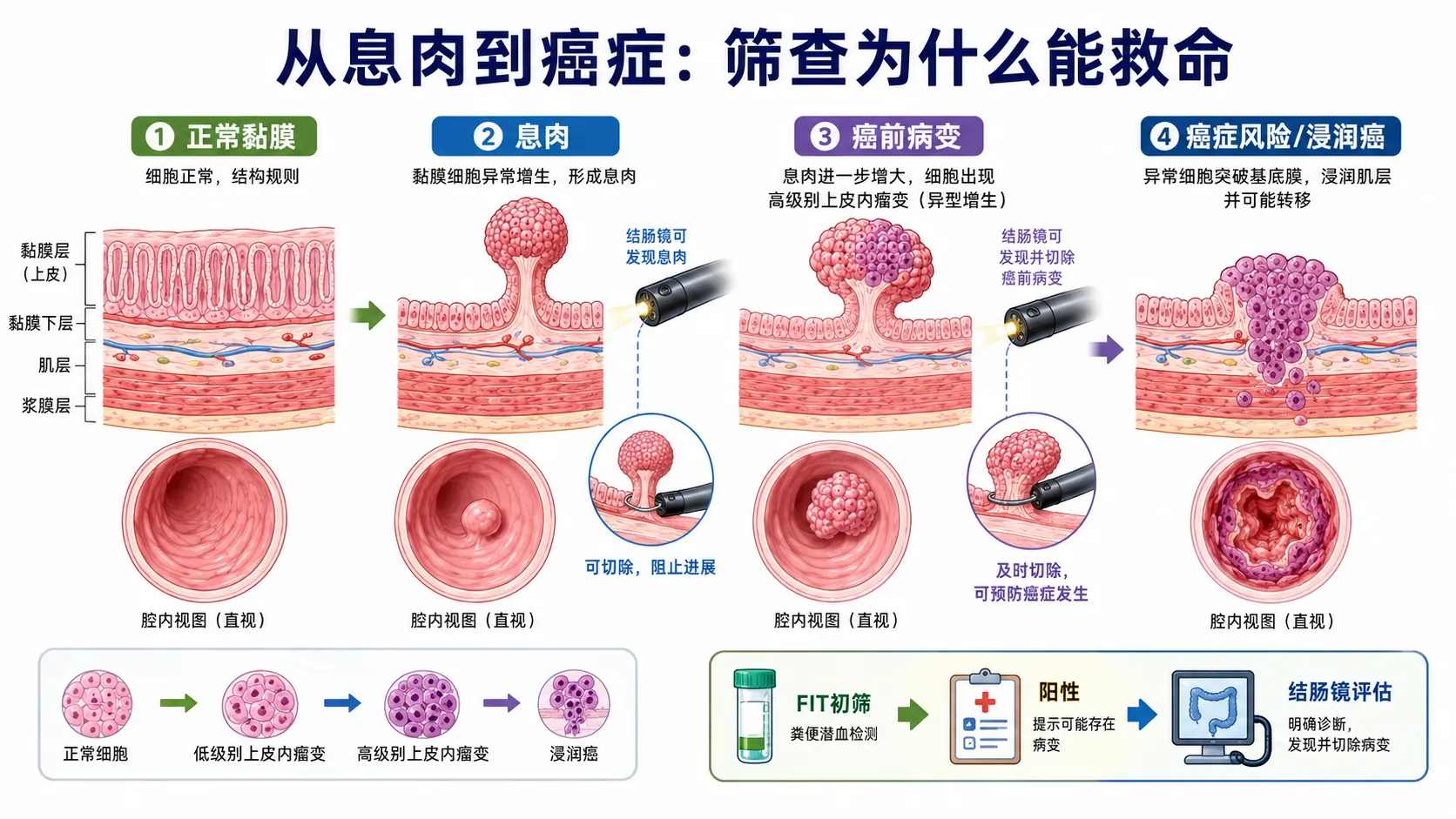 癌前病变不是癌，但可能是通往癌的路口