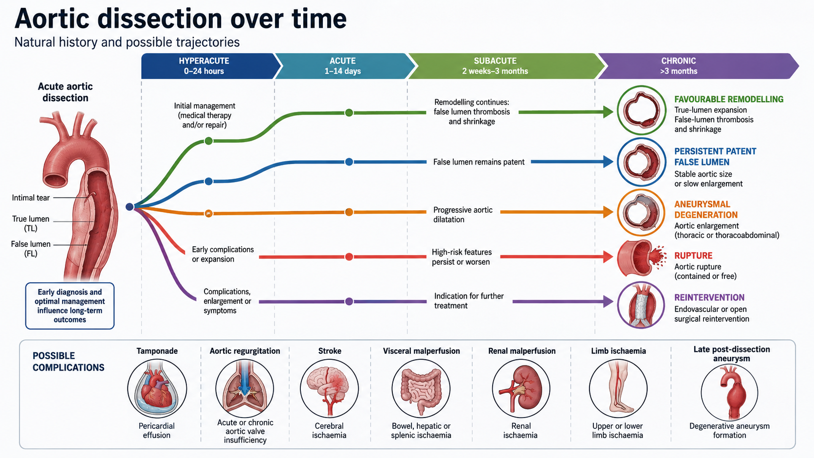 Figure 10: Natural history from acute dissection to chronic remodelling, aneurysmal degeneration, rupture and reintervention