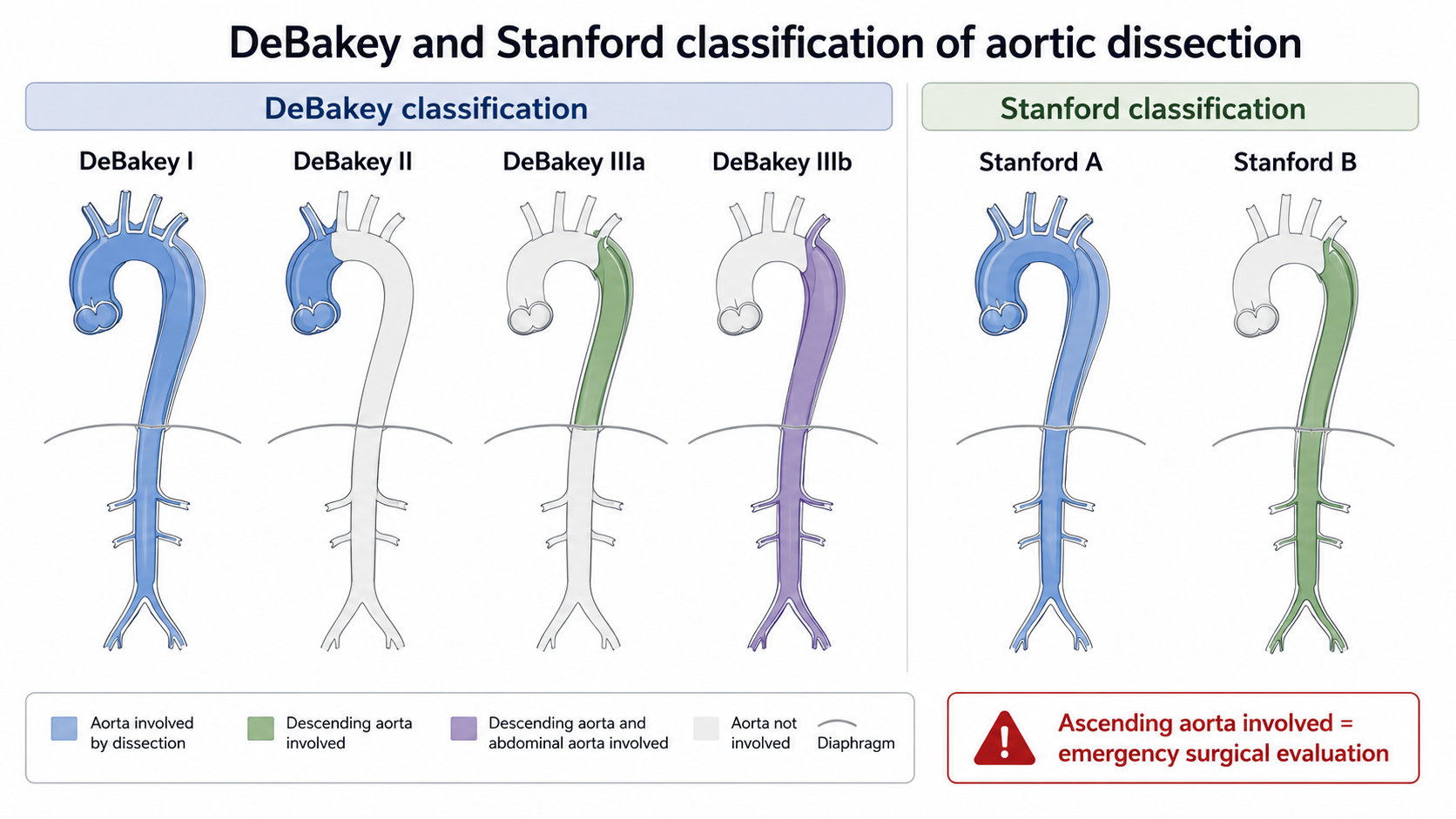 Figure 4: DeBakey and Stanford classification comparison