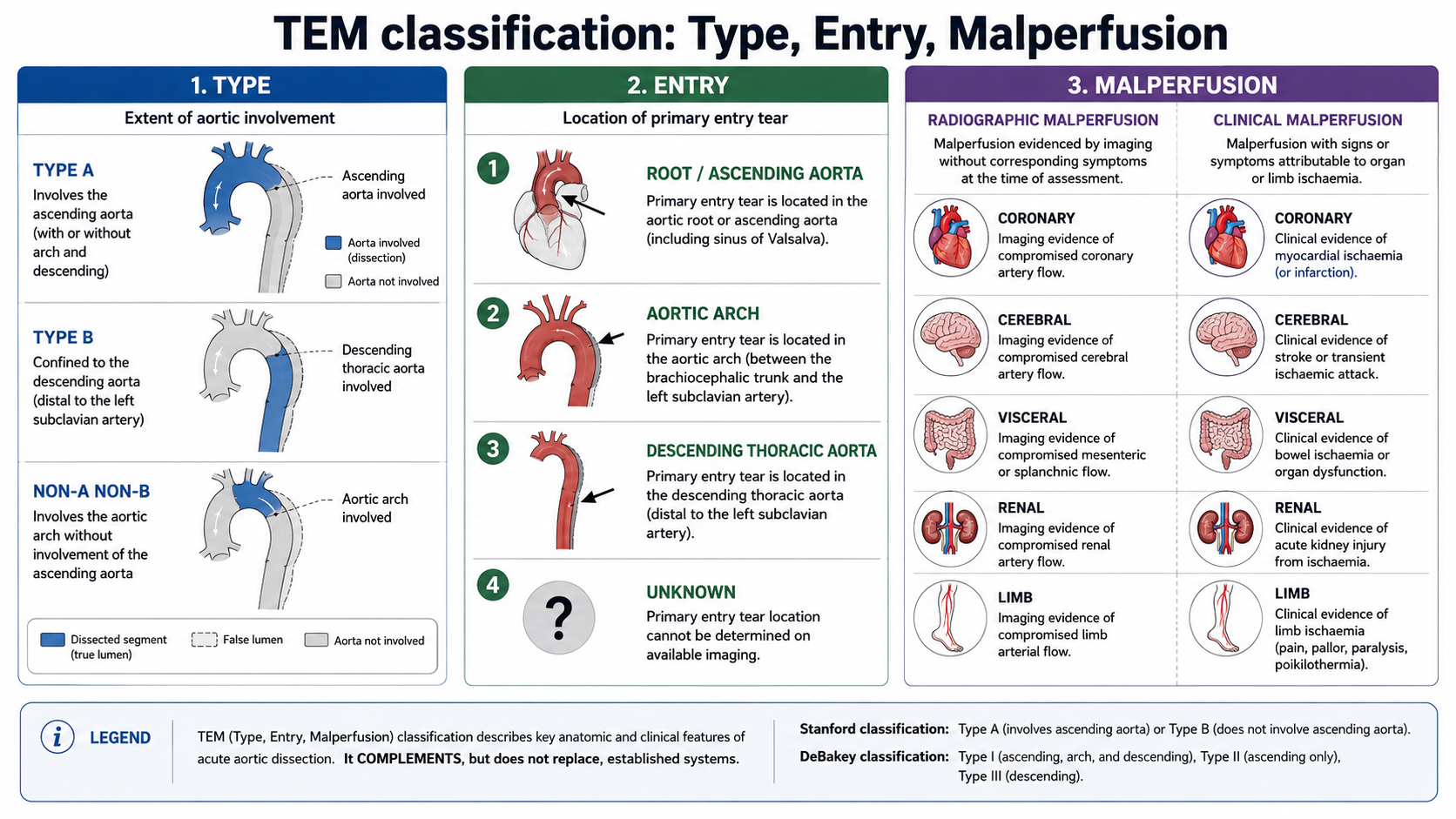 Figure 5: Type–Entry–Malperfusion classification with examples of type, entry site and malperfusion domains