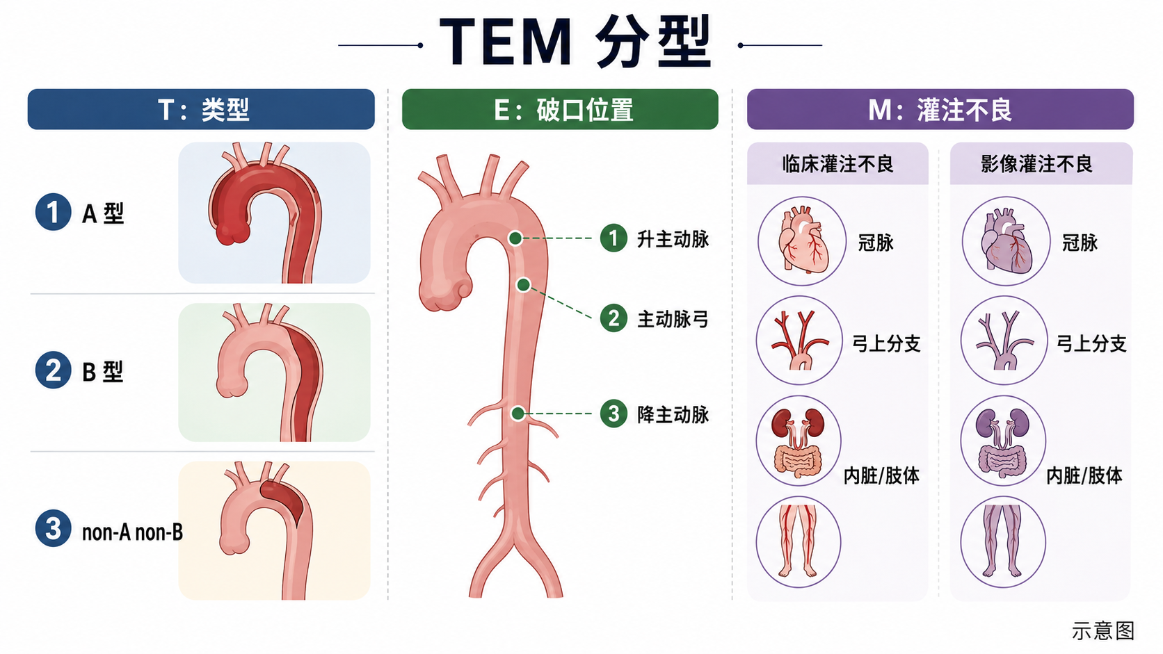 图4｜TEM 分型示意图