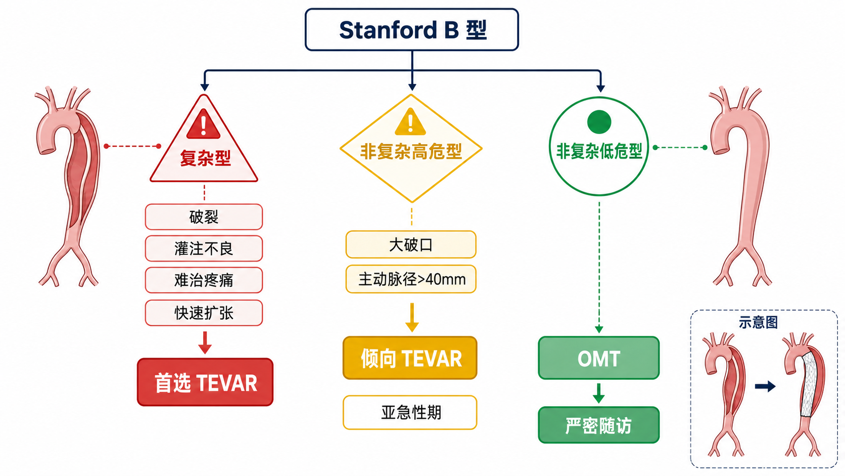 图8｜Stanford B 型治疗决策树